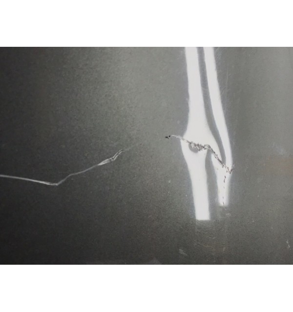 Капот бу для Kia Ceed  1.6 CRDi,  2009 г.